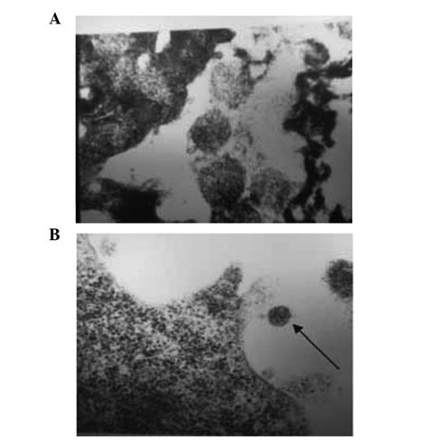 Transmission Electron Microscopy Results Following Treatment In