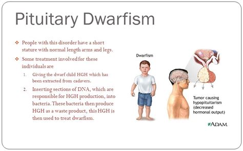 Diagnosing Growth Hormone Deficiency: Early Detection Is The Key