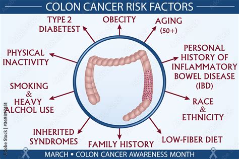 Colon Cancer Risk Factors Infographic Vector March Colon Cancer