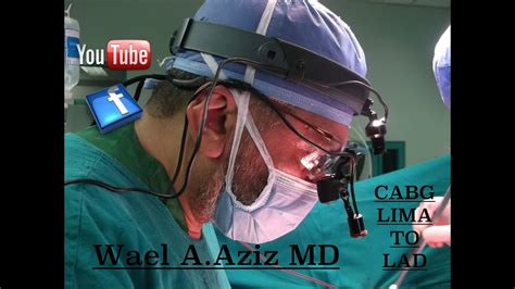 Open Heart Surgery Cabg X4 Lima To Lad Wael Abdul Aziz Md Youtube