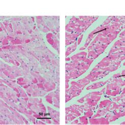 Lps Induced Myocardial Injury In A Rat Model A H E Staining Showed