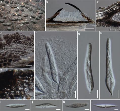 Fissuroma Fissuristoma Facesoffungi Number Fof Faces Of Fungi