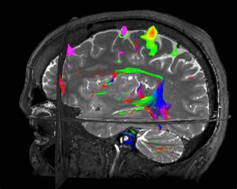 Functional Magnetic Resonance Imaging Fmri Department Of Neurology