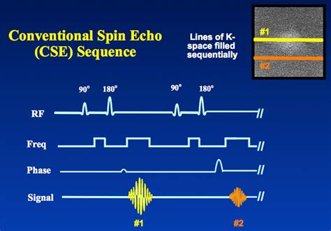 Tse Fse Questions And Answers In Mri