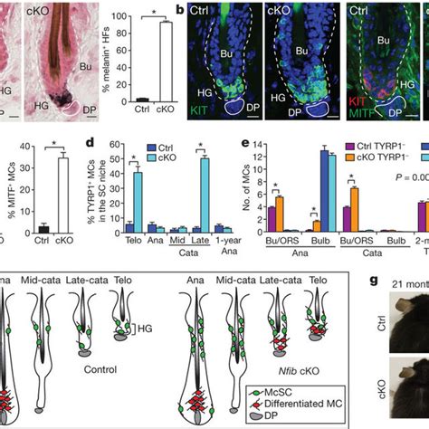 Nfib Loss Enhances Melanocyte Stem Cell Self Renewal And Perturbs