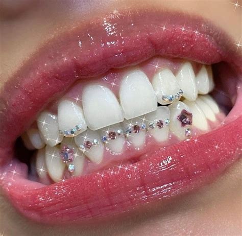 Pin By 🖤 On Jewels Tooth Gem Teeth Jewelry Diamond Teeth