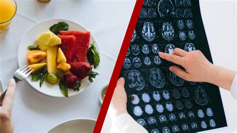 Los 6 Mejores Alimentos Para Fortalecer El Cerebro Según Experta De