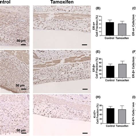 Estrogen Receptors And Proliferation A Representative Histology Of