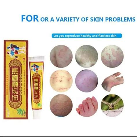 Jual Salep Obat Gatal Gatel Jamur Eksim Anti Bakteri Psoriasis Dermatitis Shopee Indonesia