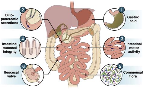 Small Intestinal Bacterial Overgrowthpathophysiology And Its