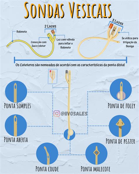 Sonda Vesical De Demora Sigla Revoeduca