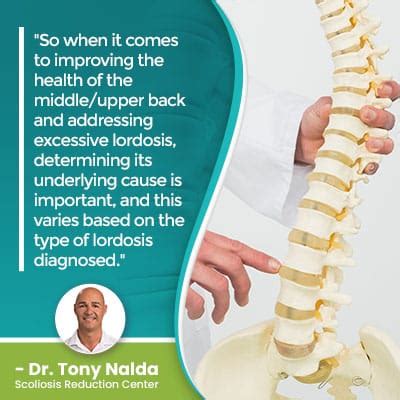 Thoracic Lordosis: What Is It, Symptoms, & Treatment Options