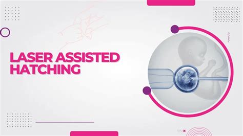 Best Laser Assisted Hatching Treatment In Bangalore Ovum Fertility