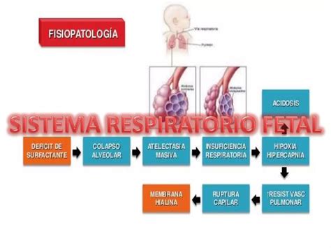 Sindrome De Dificultad Respiratoria En El Reci N Nacido Ppt