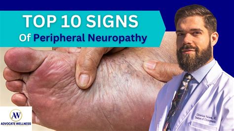 Top 10 Signs Of Peripheral Neuropathy Bonus At End Youtube