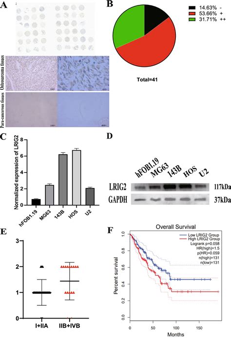 The Expressions Of Lrig2 In Osteosarcoma Tissues And Cell Lines And