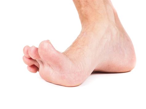 Locating foot pain - Consulting Footpain