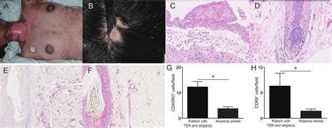 Clinical Manifestation And Histological Examination A Clinical