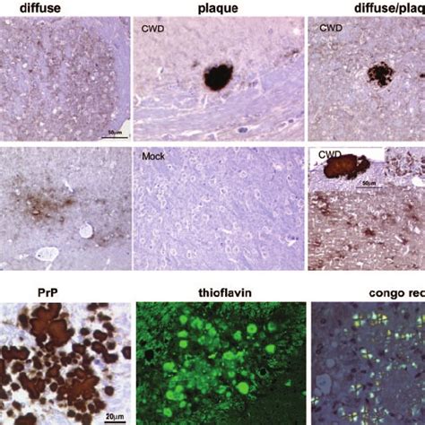 Plaque Characterization In CWD Infected Mice A PrP Sc Deposits Vary