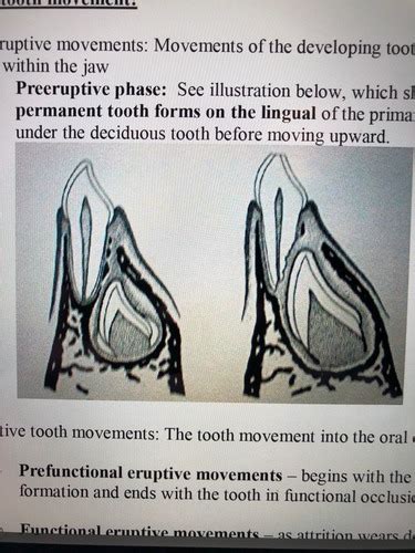 Dhy 250 Ch 6 Tooth Shedding And Eruption Flashcards Quizlet