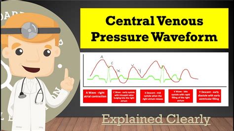 Central Venous Pressure Cvp Waveform And Tracing Basics A C X V