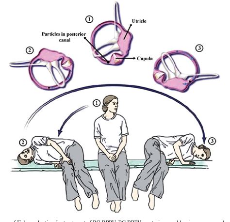 Figure 2 From Advances In The Diagnosis And Treatment Of Benign