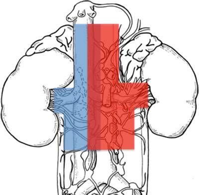 Frontiers The Effect Of Anatomical Location Of Lymph Node Metastases