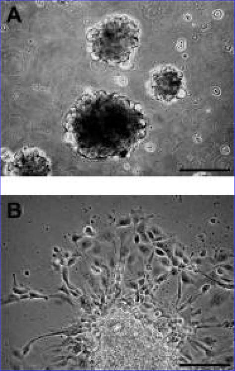 Aggregation Of Zeb2j Cells In Suspension Culture And Subsequent