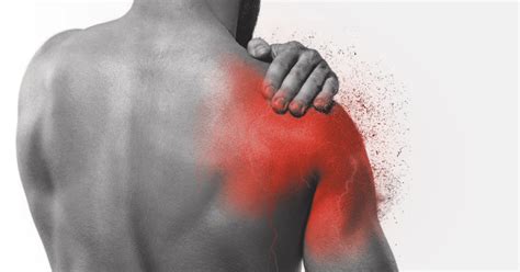 Frozen Shoulder Causes Symptoms And Treatment Options