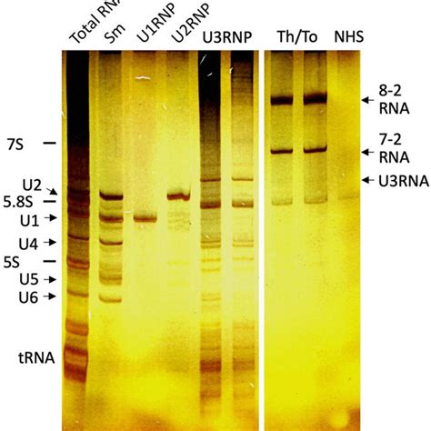 Immunofluorescence Antinuclear Antibodies Hep 2 Ana Slides Mbl Inc