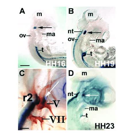 Expression Of Lbx1 In The Pre Otic Head Mesenchyme A D HH16 23 Chick