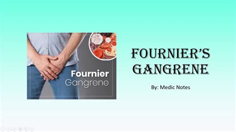 Fournier S Gangrene Risk Factors Clinical Features Investigation