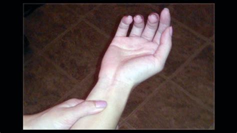 Relieve Nausea by Pressing on the Inside of Your Wrist