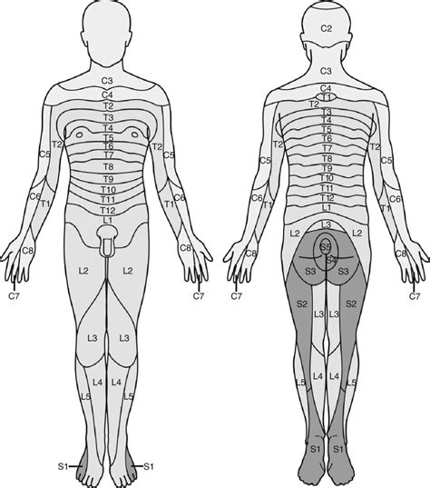 Spinal Anesthesia Dermatome Levels - Dermatomes Chart and Map