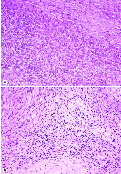 A Fascicles Of Spindle Smooth Muscle Cells On The Right Side Of The