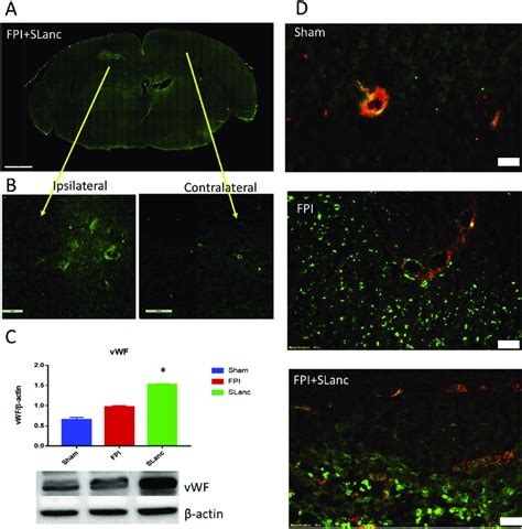 Higher Expression Of Vascular Markers In The SLanc Treated Injury Brain