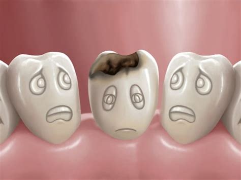 Cómo evitar las caries en los niños DIARIO AHORA