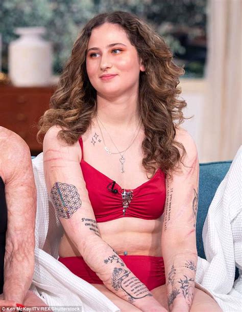 Women With Disfigurements Proudly Display Scars On This Morning Daily