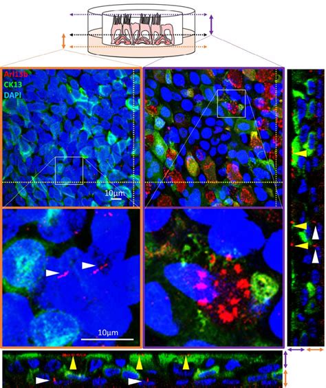 Primary Cilia And Motile Cilia Appear During Airway Epithelial Cell Download Scientific Diagram