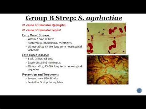 Group B Streptococcus GBS - YouTube