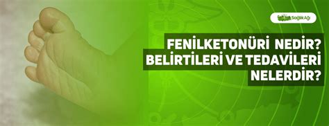 Fenilketon Ri Nedir Belirtileri Ve Tedavileri Nelerdir Sa L K A