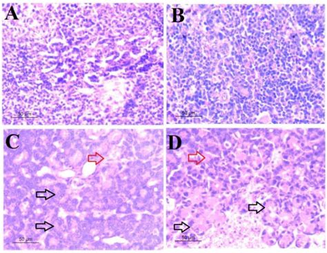 Photomicrograph Of Three Collected Organs Brain Liver Spleen