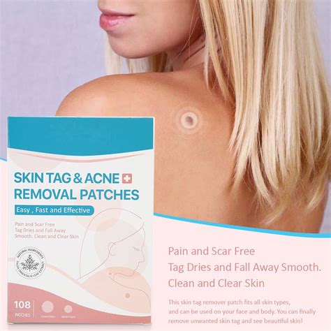 Skin Tag Removal Stickers Skin Tag Removal Patch Wart Removal