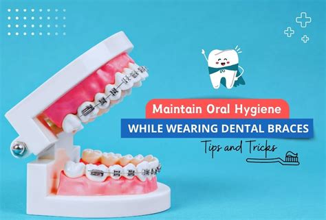 How To Maintain Oral Hygiene While Wearing Dental Braces Tips And