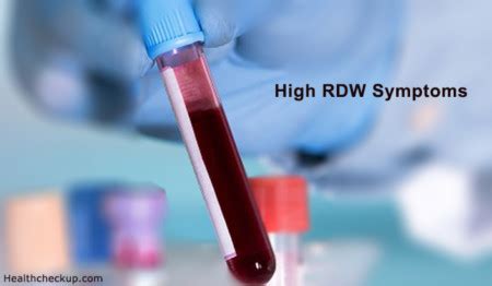 High RDW Symptoms, Causes, Test & Treatment - Health Checkup