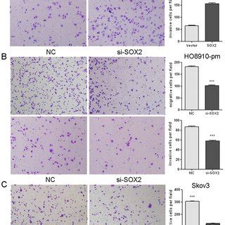 Sox Promotes Cell Migration And Invasion In Soc Cells A Stable