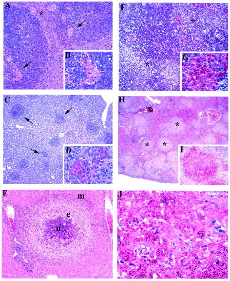 Differential Cytokine Pattern In The Spleens And Livers Of Balbc Mice