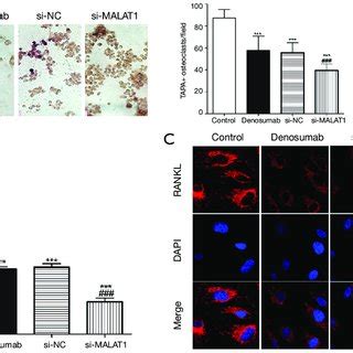 MALAT1 Regulates Spontaneous Osteoclastogenesis Of RAW 264 7 Cells