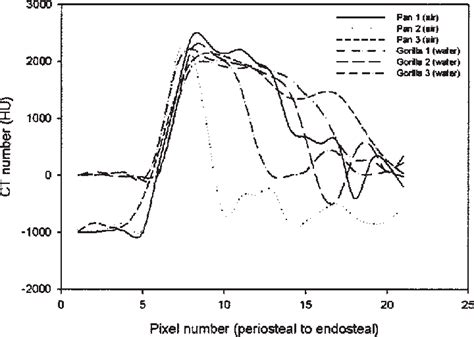 Ct Numbers Hounsfield Units Hu Over Linear Pixel By Pixel Download Scientific Diagram