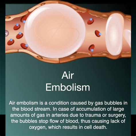 Vascular And Hyperbaric Unit